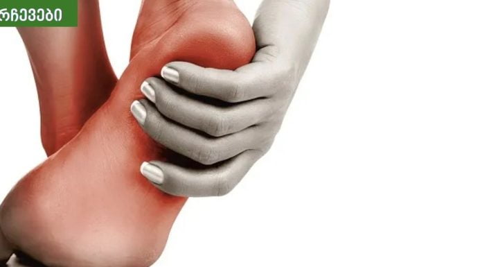 ექიმმა მასწავლა დაბზარული ქუსლების მკურნალობა.