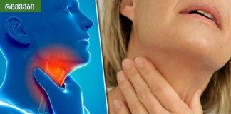 ეს არის ძველი, ტრადიციული რეცეპტი, რომელიც ათავისუფლებს ყელის ტკივილს რამდენიმე საათში