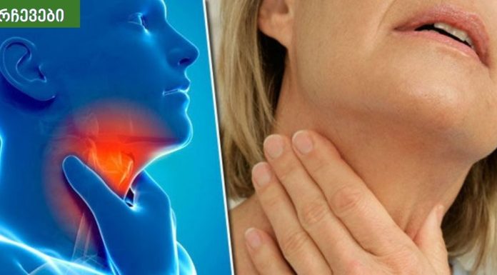 ეს არის ძველი, ტრადიციული რეცეპტი, რომელიც ათავისუფლებს ყელის ტკივილს რამდენიმე საათში