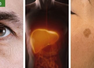 სიმპტომიები, რომელებიც უნდა იცოდეთ ღვიძლის პრობლემებზე