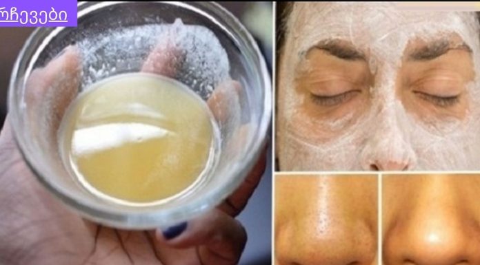 საოცარი C ვიტამინის კომპლექსი კანის გასაწმენდად