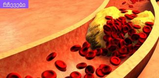 მაღალი ქოლესტერინი და მაღალი წნევა ძალიან საშიში და ძალიან გავრცელებული პრობლემაა.ქოლესტერინისა და ჰიპერტენზიის წინააღმდეგ ბრძოლის 8 გზა