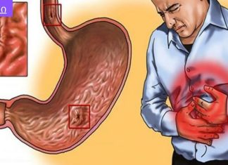 რა სამწუხაროა, რომ ამდენი ხანი ვიტანჯე ტკივილებით და ადრე არ ვისწავლე ამ მეთოდების შესახებ!ხალხური საშუალებები გასტრიტის სამკურნალოდ