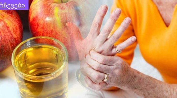 ჩემმა მეზობელმა მასწავლა ეს სასწაული რეცეპტი.ვაშლის ძმარი ხელს შეუწყობს სახსრების განკურნებას.