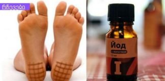 რატომ არის ძალიან სასარგებლო ქუსლის იოდით შეღებვა ღამით