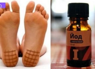 რატომ არის ძალიან სასარგებლო ქუსლის იოდით შეღებვა ღამით