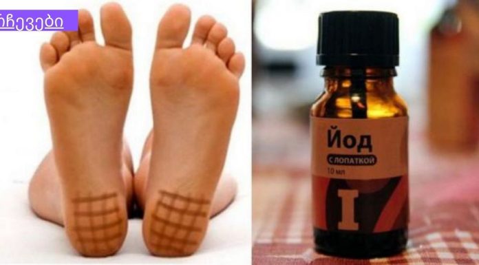 რატომ არის ძალიან სასარგებლო ქუსლის იოდით შეღებვა ღამით