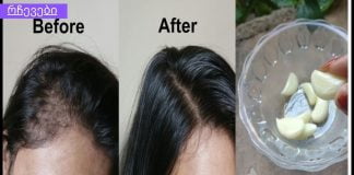 ნივრის ზეთი თმის ზრდისთვის