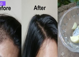 ნივრის ზეთი თმის ზრდისთვის