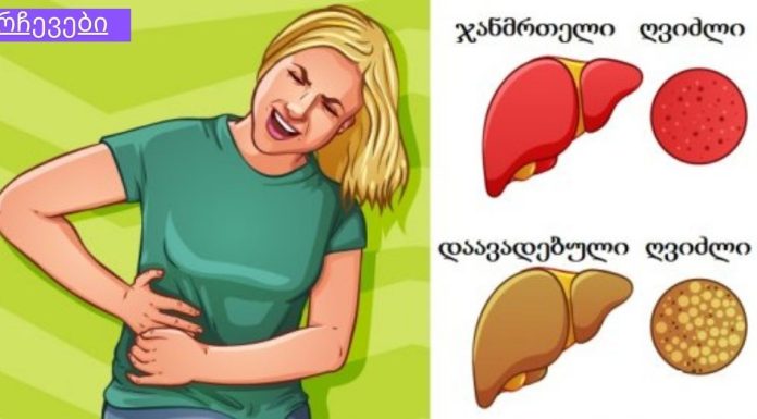 ღვიძლს გაწმენდა გსურთ სახლის პირობებში?მაშინ ეს შენთისაა. ასევე წვავს მუცლის ცხიმს და აღადგენს მხედველობას მხოლოდ ერთი ბოსტნეულის წყალობით