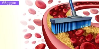 9 საკვები, რომელიც წმენდს არტერიებს