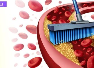 9 საკვები, რომელიც წმენდს არტერიებს