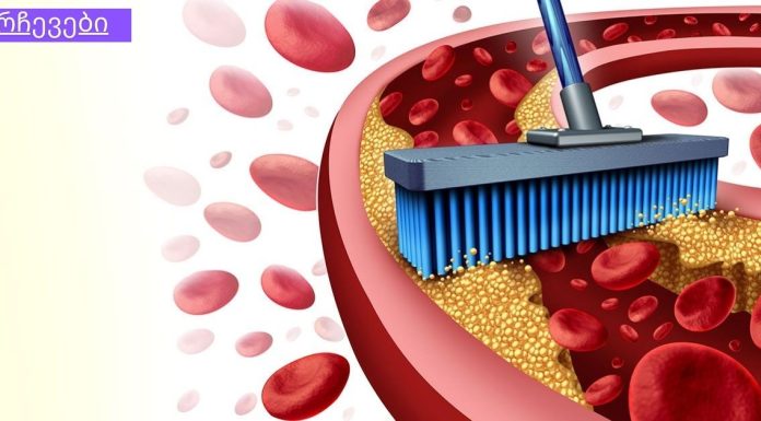 9 საკვები, რომელიც წმენდს არტერიებს