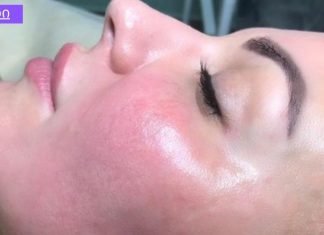 ვაშლის ნარევი ცხიმიანი კანისთვის