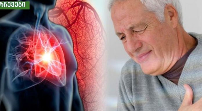 ეს არ უნდა გამოგრჩეთ.გულის დაავადების ყველაზე საშიში სიმპტომები.
