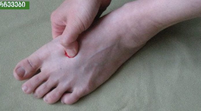 შეიზილეთ ეს წერტილი ფეხზე – მას აქვს საოცარი სამკურნალო თვისებები