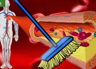 მეთოდი ,რომელიც გაგაოცებთ – სისხლძარღვების წმენდა. საუკეთესო პრაქტიკა.