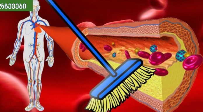 მეთოდი ,რომელიც გაგაოცებთ – სისხლძარღვების წმენდა. საუკეთესო პრაქტიკა.