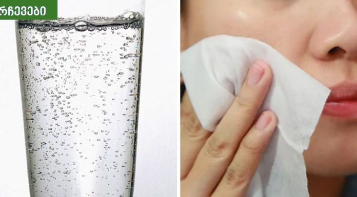 ამ ქალბატონს გაზიანი წყლით ულამაზესი სახის კანი გაუხდა,თვითონაც არ ელოდა ამ შედეგს.გაზიანი წყლის მოულოდნელი სარგებელი თქვენს კანზე