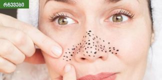 შავი წერტილების მოშორების უმარტივესი მეთოდები ყველა ასაკისთვის.