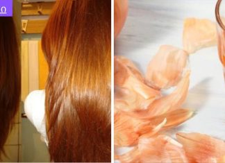 ხახვის ქერქის უამრავი სარგებელი ჯანმრთღელობასა და სილამაზეში.