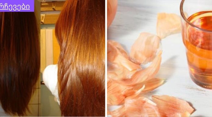 ხახვის ქერქის უამრავი სარგებელი ჯანმრთღელობასა და სილამაზეში.