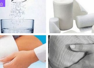 მარილის სახვევი – მარილით მკურნალობა.