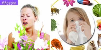 გაზაფხულია და ყველა მეორე ადამიანის “ტკივილია” ალერგია,მტვრის ალერგია.