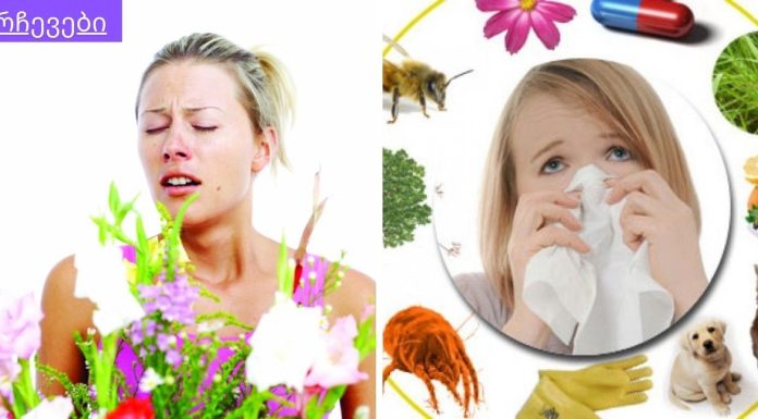 გაზაფხულია და ყველა მეორე ადამიანის “ტკივილია” ალერგია,მტვრის ალერგია.