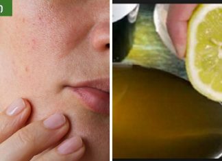 დაემშვიდობეთ მსხვილ ფორებს სახეზე.