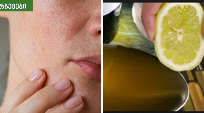 დაემშვიდობეთ მსხვილ ფორებს სახეზე.