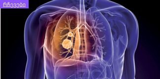 თუ გსურთ ფილტვები ტოქსინებისგან გაანთავისუფლოთ ეს ნაყენი დაგეხმარებათ.