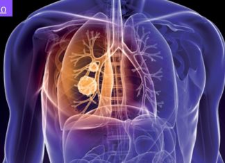 თუ გსურთ ფილტვები ტოქსინებისგან გაანთავისუფლოთ ეს ნაყენი დაგეხმარებათ.