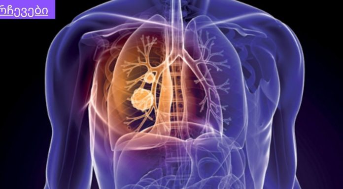 თუ გსურთ ფილტვები ტოქსინებისგან გაანთავისუფლოთ ეს ნაყენი დაგეხმარებათ.