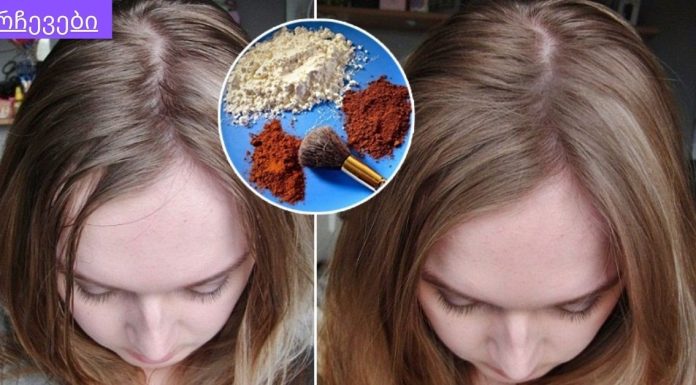 საუკეთესო შამპუნი ცხიმიანი თმისთვის თქვენი სამზარეულოდან