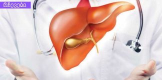 როგორ დავეხმაროთ ღვიძლს ნორმალურ ფუნქციონირებაში. ბუნებრივი გზები.