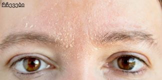 ატენიანეთ მშრალი კანი საუკეთესო სახლის საშუალებებით