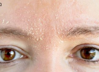 ატენიანეთ მშრალი კანი საუკეთესო სახლის საშუალებებით