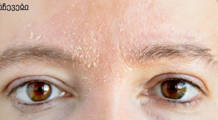 ატენიანეთ მშრალი კანი საუკეთესო სახლის საშუალებებით