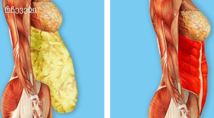 სად იმალება ორგანიზმში ტოქსიკური ნივთიერებები, სად უნდა ვეძებოთ წონის მომატების მიზეზები