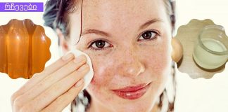 ჯადოსნური რეცეპტი ჭორფლების მარტივად სამკურნალოდ.