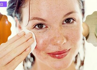 ჯადოსნური რეცეპტი ჭორფლების მარტივად სამკურნალოდ.