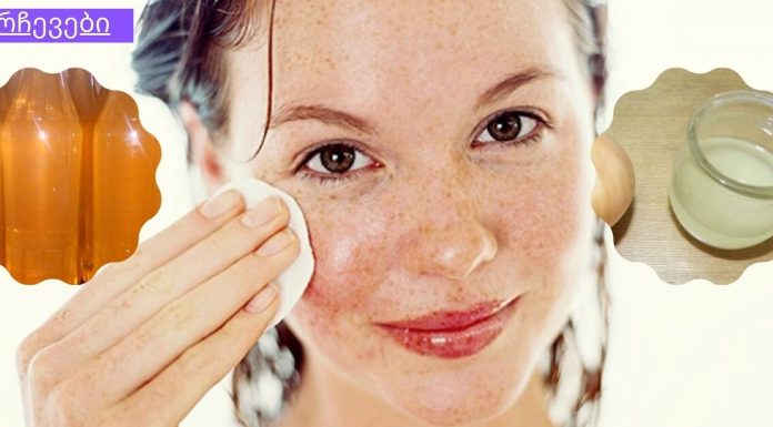 ჯადოსნური რეცეპტი ჭორფლების მარტივად სამკურნალოდ.