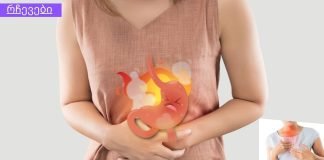 გულძმარვის სამკურნალო ხალხური საშუალებები: სოდა, ბანანი, კოჭა, მწვანილი და საღეჭი რეზინი