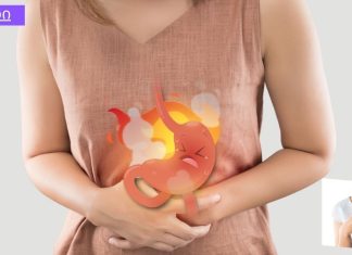 გულძმარვის სამკურნალო ხალხური საშუალებები: სოდა, ბანანი, კოჭა, მწვანილი და საღეჭი რეზინი