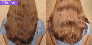 ჩვეულებრივი ასპირინის ტაბლეტები თქვენს თმას ბზინვარებასა და სქელს გახდის