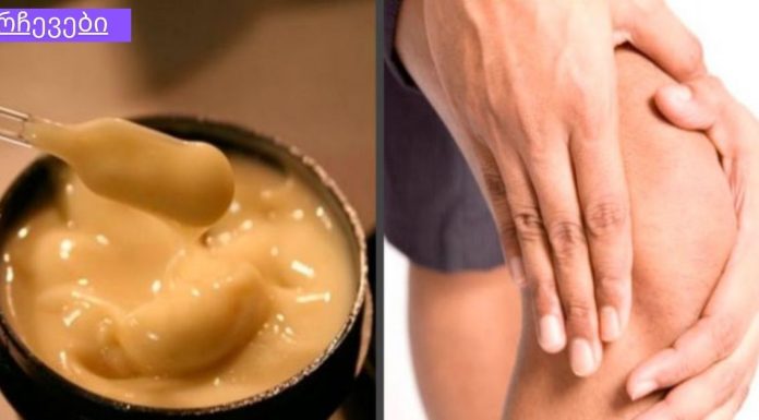 მუხლის და სახსრების მკურნალობა მარტივი რეცეპტით. მთელი მსოფლიო აღფრთოვანებულია მისით!