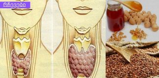 გადაუჭრელი პრობლრემა გგონიათ ჩიყვის პრობლემები? გაეცანით ამ სტატიას და იმკურნალეთ უმარტივესად.