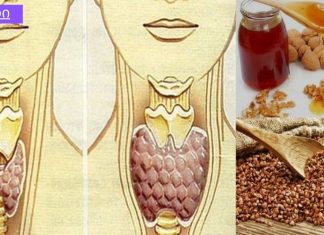 გადაუჭრელი პრობლრემა გგონიათ ჩიყვის პრობლემები? გაეცანით ამ სტატიას და იმკურნალეთ უმარტივესად.