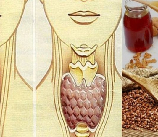 გადაუჭრელი პრობლრემა გგონიათ ჩიყვის პრობლემები? გაეცანით ამ სტატიას და იმკურნალეთ უმარტივესად.